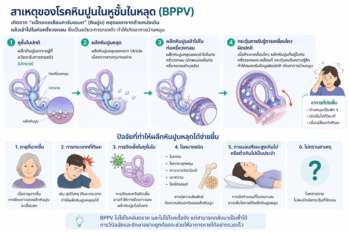 โรคหินปูนในหูชั้นในหลุด (BPPV)