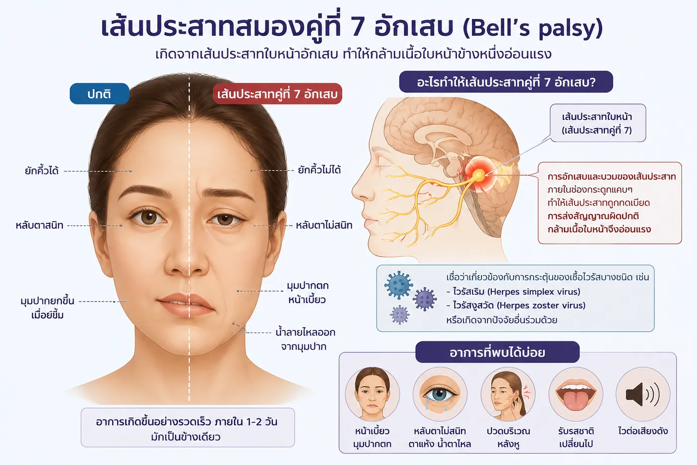 เปรียบเทียบอาการ Bell's palsy กับปกติ