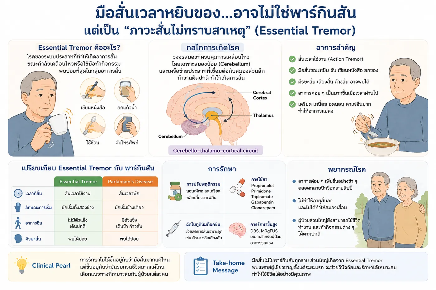 ภาวะสั่นไม่ทราบสาเหตุ Essential Tremor