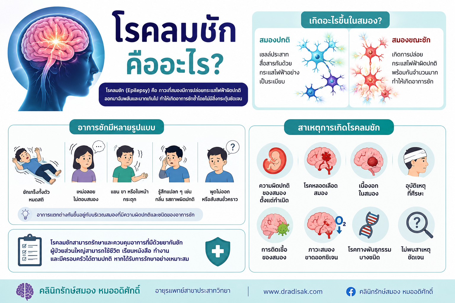โรคลมชักคืออะไร