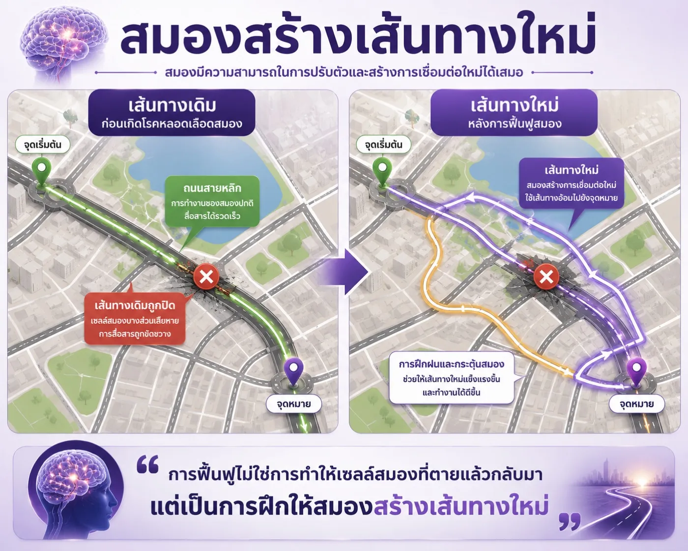 สมองสร้างเส้นทางใหม่หลังโรคหลอดเลือดสมอง เปรียบเหมือนเครือข่ายถนน